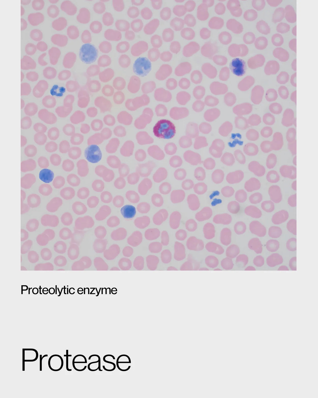 Microscopic visualisation of protease enzymes, emphasisng their function in breaking down proteins into amino acids for better absorption